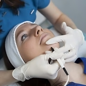 Ριζική αποτρίχωση με θερμόλυση