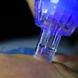 Hydrafacial Υδροδερμοαπόξεση